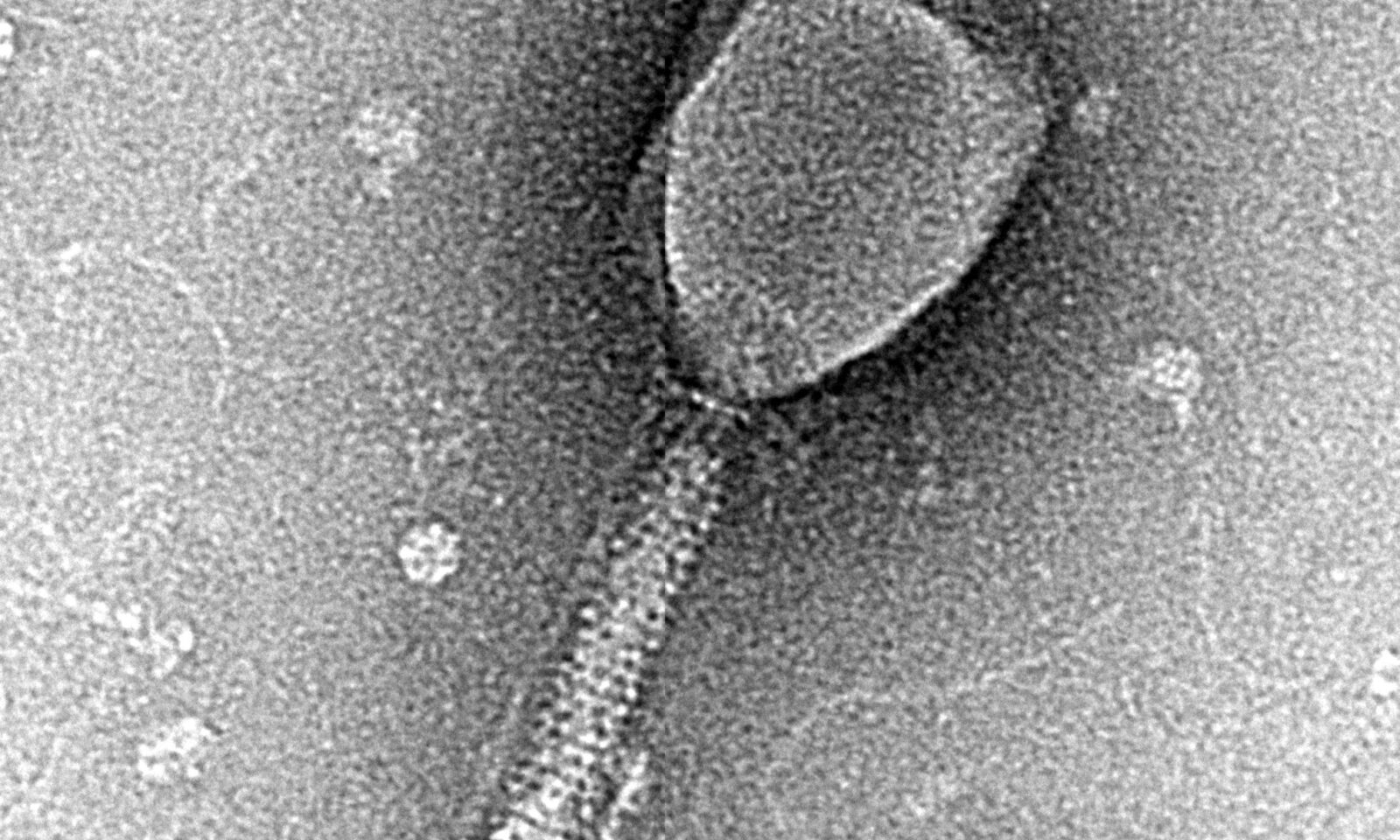 Transmission electron micrograph of a bacteriophage, a virus that infects bacteria.