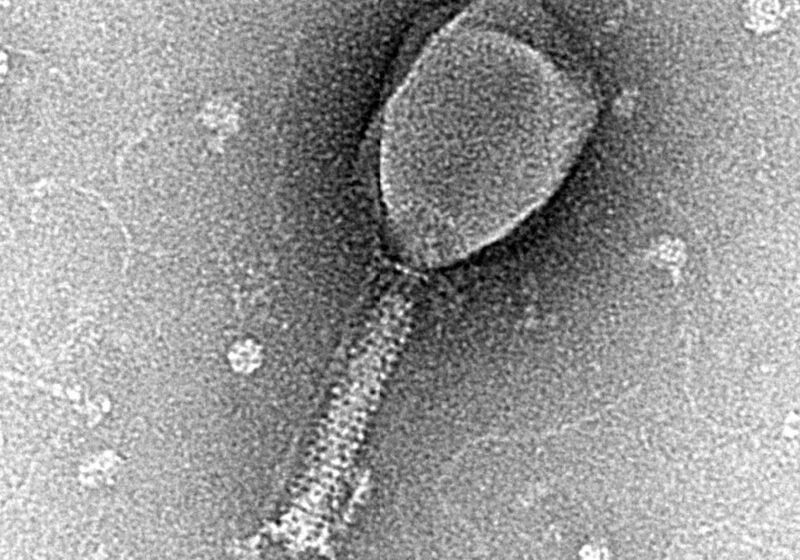 Transmission electron micrograph of a bacteriophage, a virus that infects bacteria.